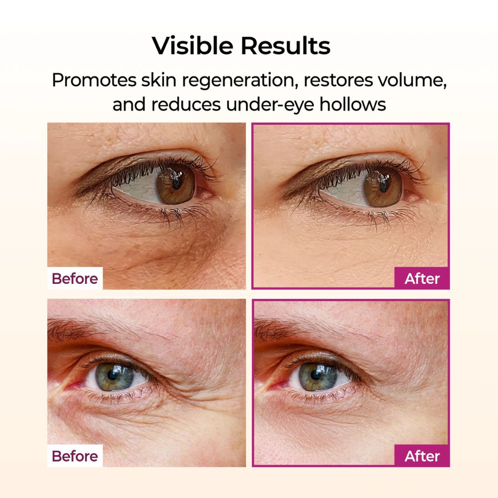 DR. MELAXIN- CEMENRETE CALCIUM MULTI BALSEM ( 9gr )