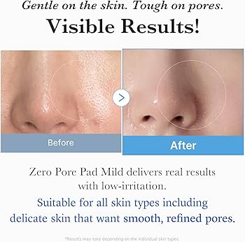 MEDICUBE- ZERO PORE MILD PADS FOR SENSITIVE SKIN ( 70 pads )