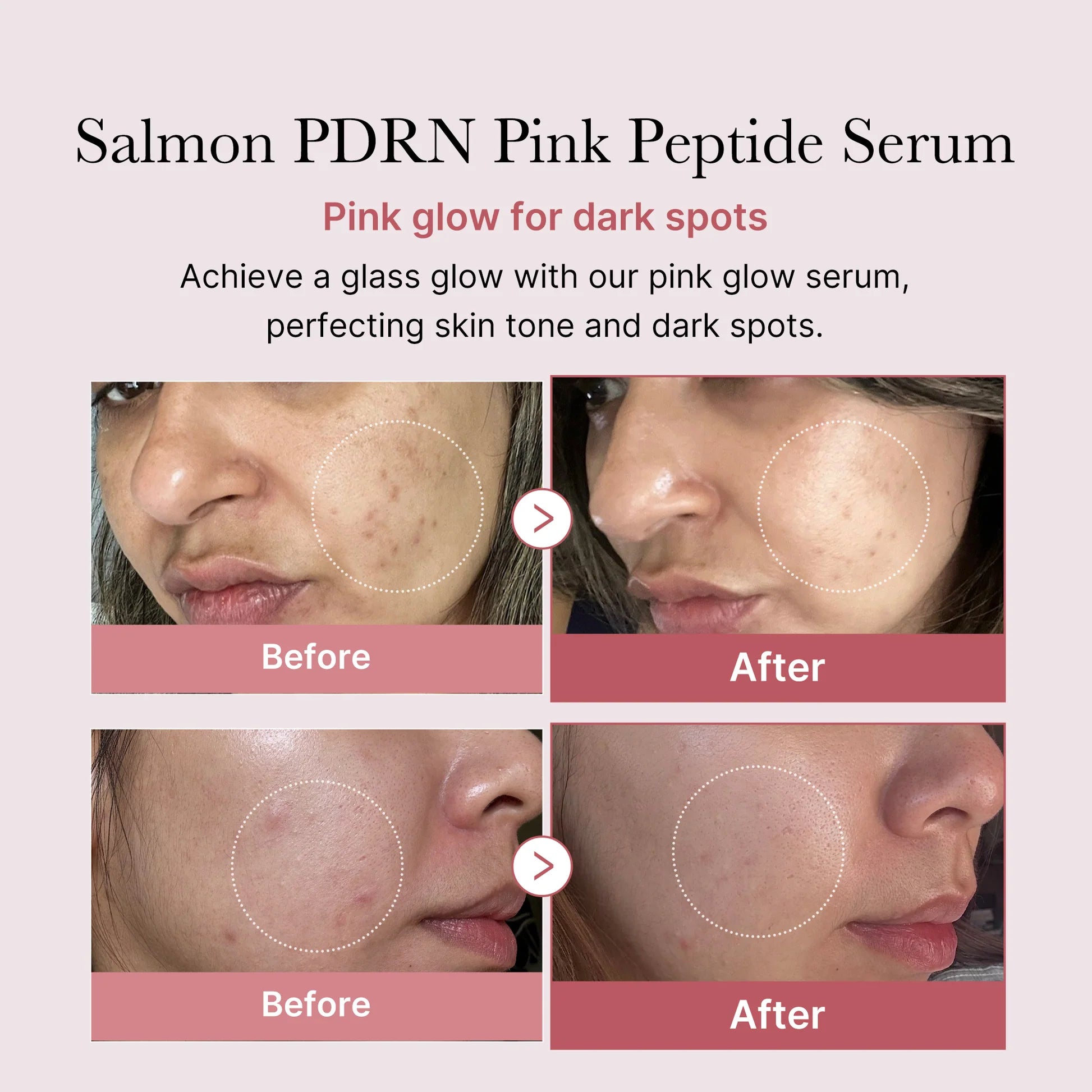 MEDICUBE PDRN PINK PEPTIDE SERUM (100ml)