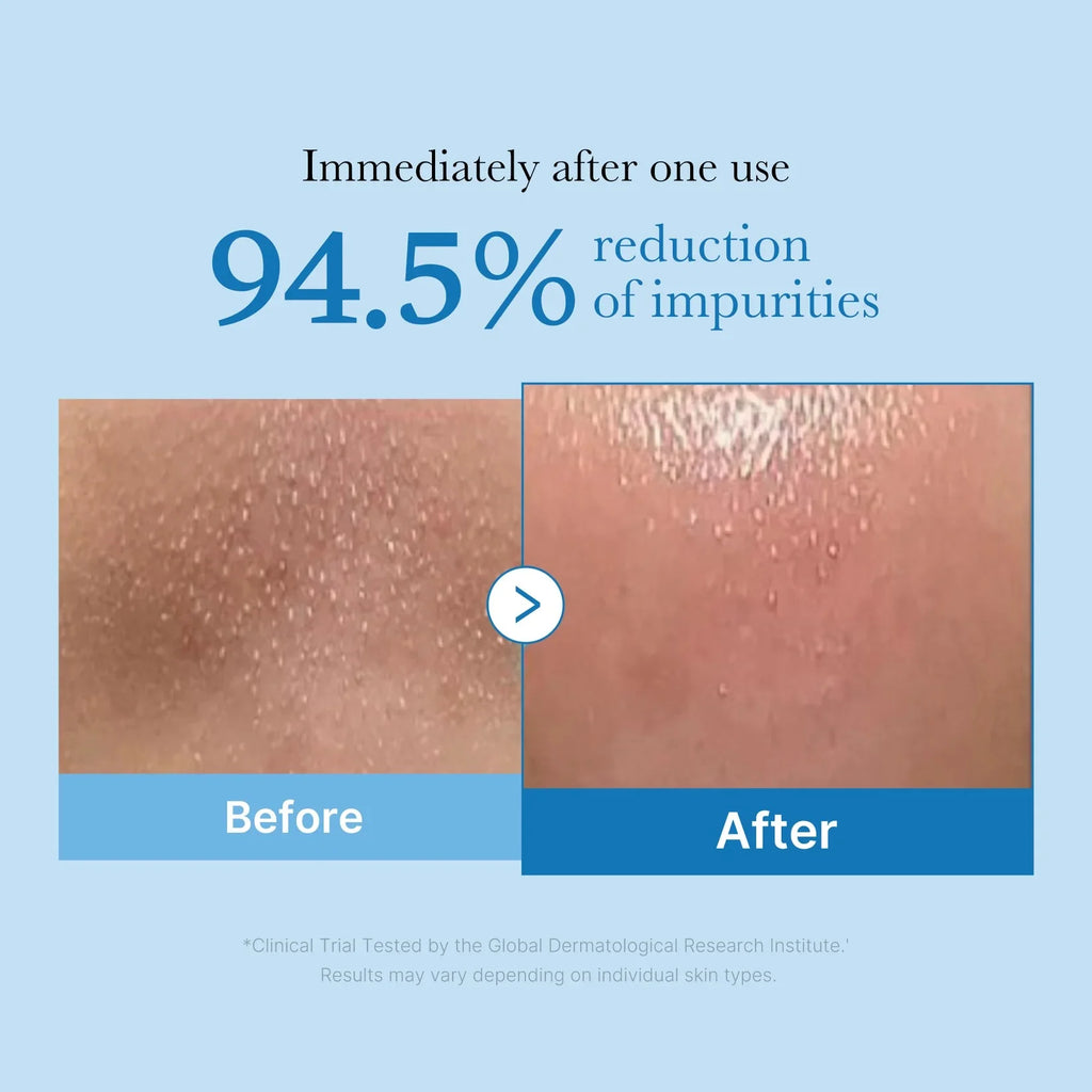 MEDICUBE – ZERO PORE COOLING MASK
